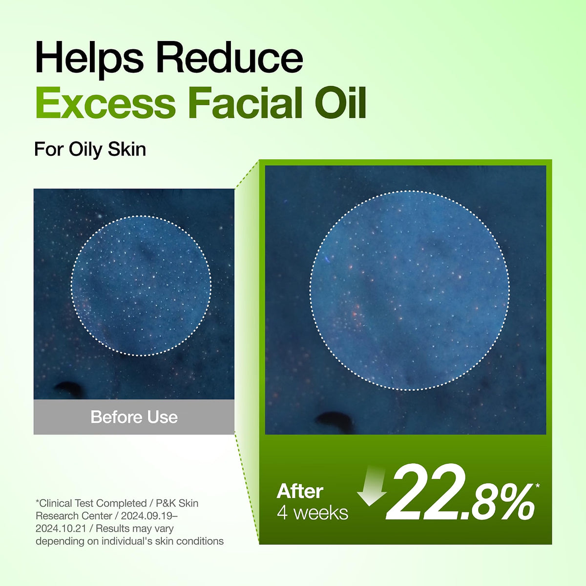 Azelaic Acid 10 Hyaluronic Acid Soothing Solution