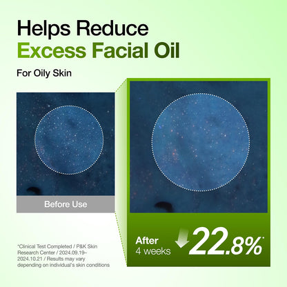 Azelaic Acid 10 Hyaluronic Acid Soothing Solution