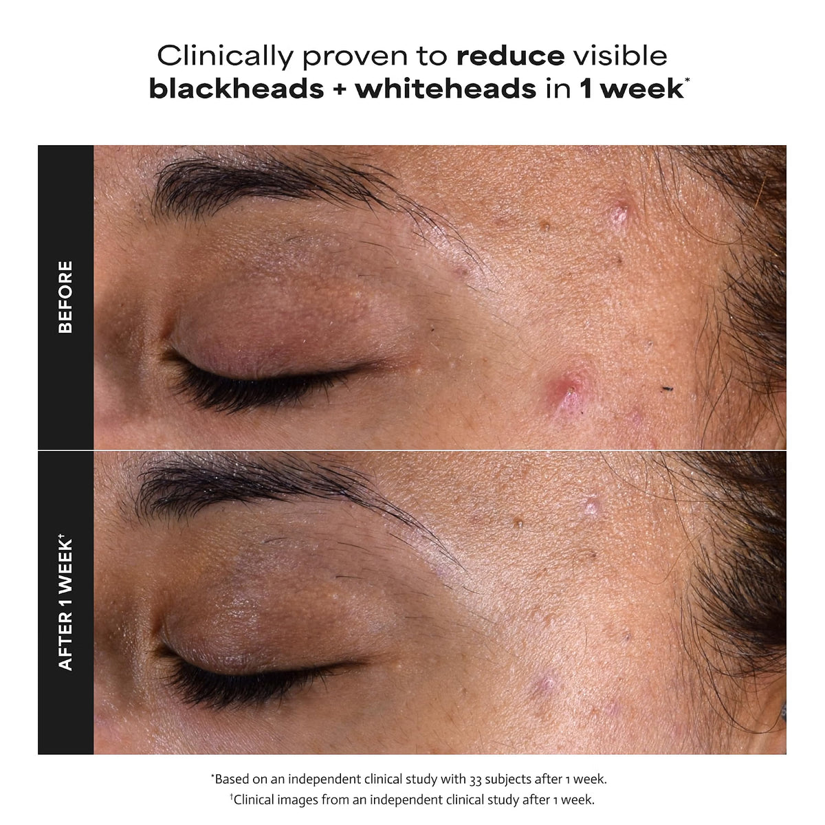 SKIN PERFECTING 2% BHA Liquid Leave