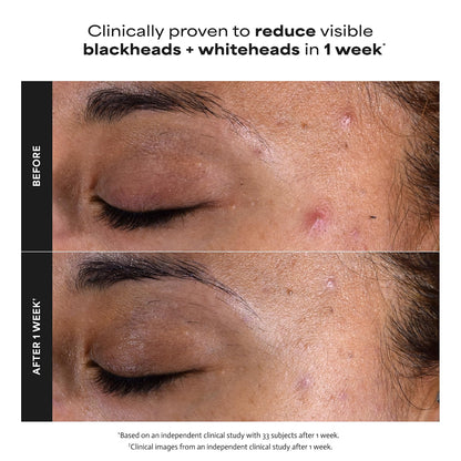 SKIN PERFECTING 2% BHA Liquid Leave