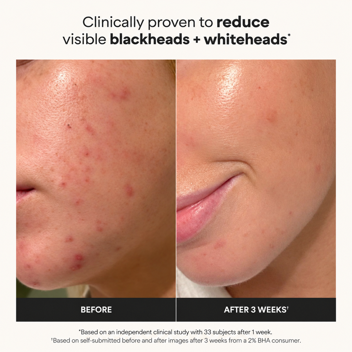 SKIN PERFECTING 2% BHA Liquid Leave