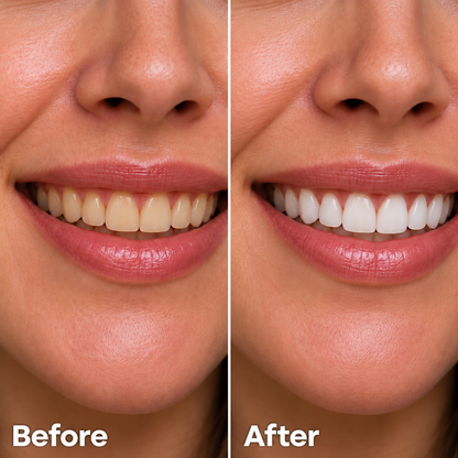 7-Pro Whitening Toothpaste