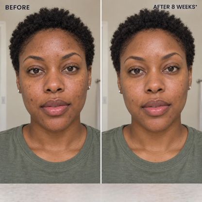 ZELYNO Dark Spot Correcting Serum
