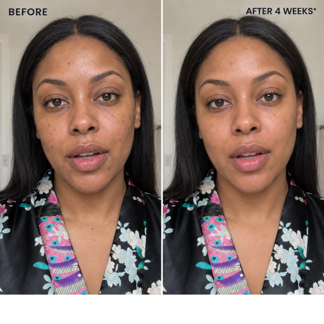 ZELYNO Dark Spot Correcting Serum